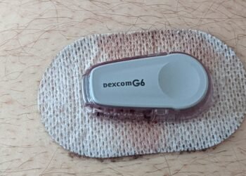 Continuous glucose monitor that shares diabetes data digitally