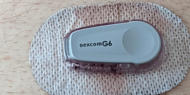 Continuous glucose monitor that shares diabetes data digitally